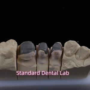 Quality Metal Cast Post Core Crown Cocr Accurate Retentive Full Zirconia Bruxier wholesale