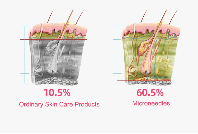 Portable Needle Free Mesotherapy Beauty Therapy Machine Anti Aging Skin Rejuvenation