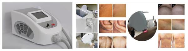 Portable 808nm diode laser painless for hair removal