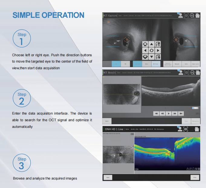 Eye Scanner Optical Coherence Tomography Non Invasive Imaging Device