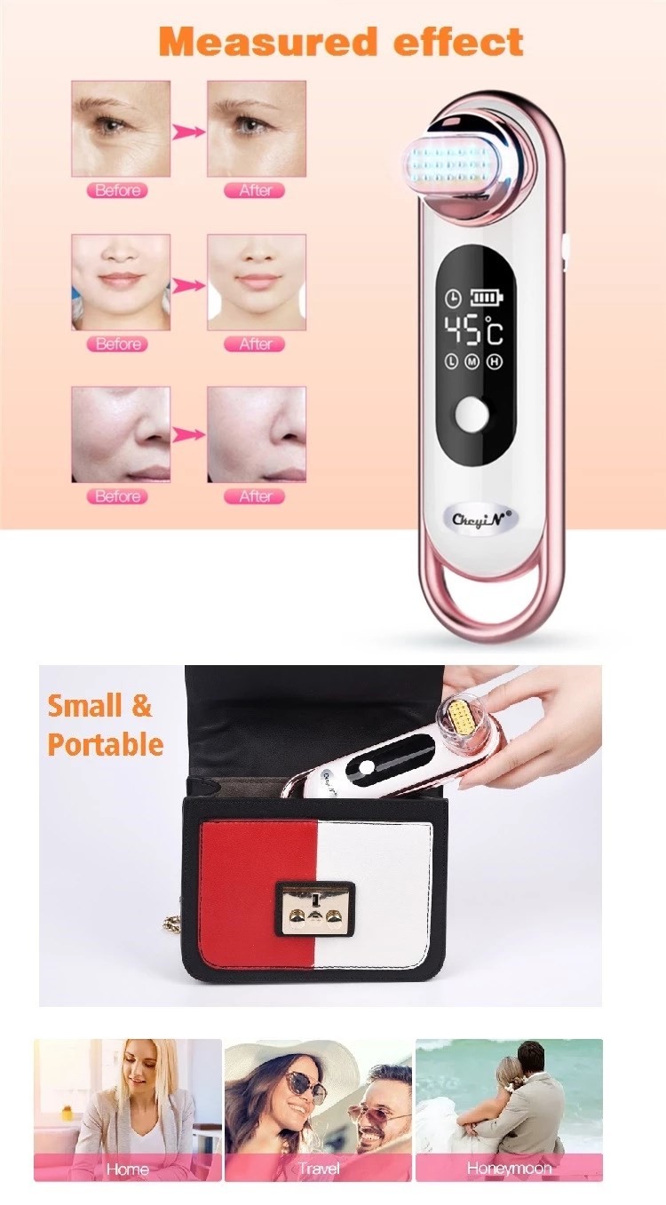 20 Mins Deep Cleaning EMS RF Hot Lifting Beauty Instrument
