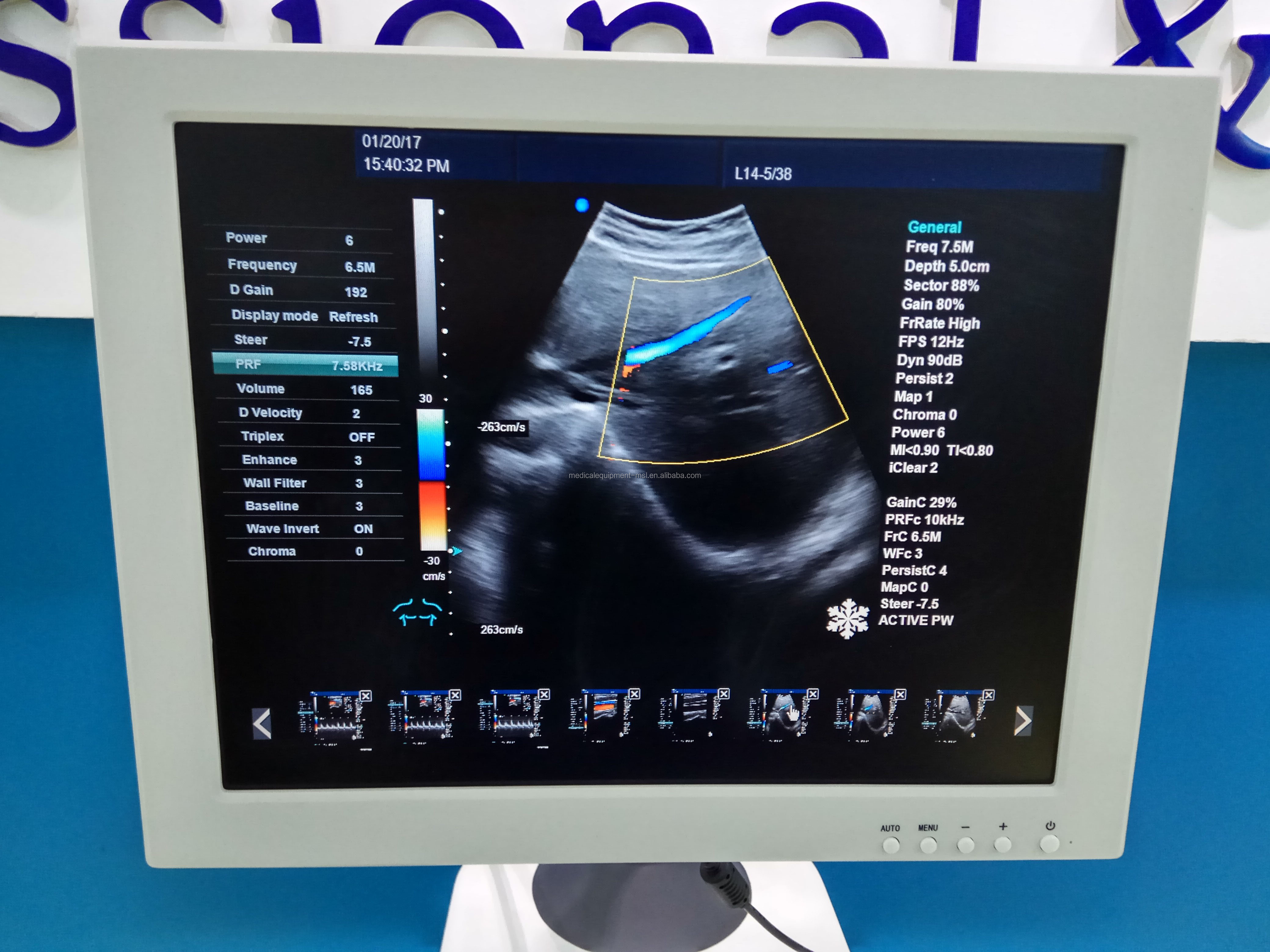 4D Color Doppler Ultrasound Machine Obstetrics And Gynecology Equipment Hospital