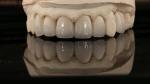 China Dental Lab Zirconia Full Contour Crown High Aesthetic Natural Dental