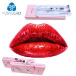 Hialuronato De Sodio Gel Volume Hyaluronic Dermal Filler For Lip Injections