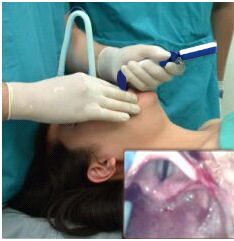 New Glidescope Portable Video Laryngoscope FOR Surgical Intruments