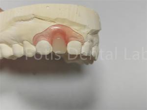 Quality Flexible Pink / Transparent Valspar Dental Partials Easy Adjustment wholesale