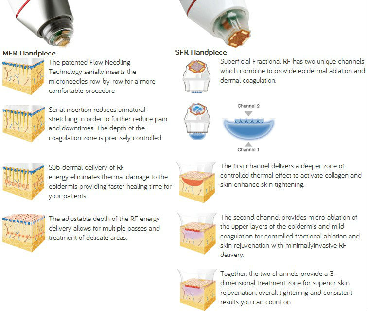 Most effective High Quality Thermage Skin Treatment Machine for Skin Treatment