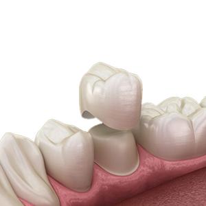 Quality OEM Natural Zirconia Dental Crown Unique Crack Resistant Tough Curing wholesale