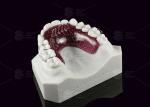 Hygienic Tongue Crib Appliance Kids / Teens Tongue Guard Orthodontic