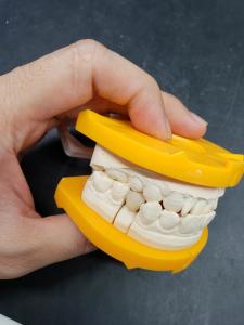 Quality Innovation At The Heart Of Our Ceramic Dental Crowns wholesale