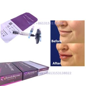 Quality 2×1ml Injectable Dermal Filler Juvederm Syringe Ultra3 Ultra4 Voluma wholesale
