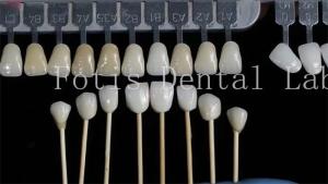 Quality Customization Natural Dental Veneers Fake Teeth Overlays High Strength wholesale