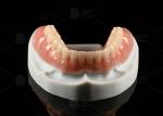 Titanium Alloy Snap On Dolder Implant Bar Overdenture Polished For Natural Smile