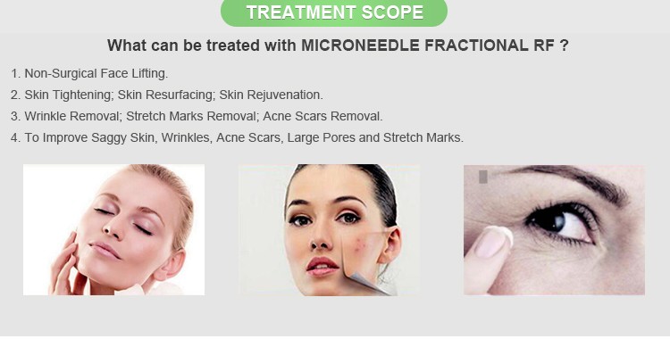 2017 Newest fractional rf/fractional rf microneedling/fractional rf micro needle machine