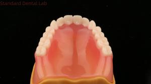 Quality Complete Denture Ivoclar Full Denture Acrylic Teeth SDL Dental Lab wholesale