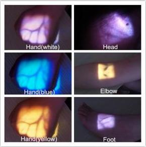 Quality Projection Infrared Medical Vein Finder Detector , Higher Accuracy Venipuncture wholesale