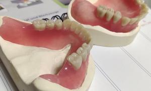 Quality Hot Cured Removable Aesthetic Lower Partial Acrylic Denture wholesale
