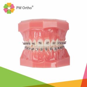Quality Easy Ligation Orthodontic Passive Self Ligating Brackets Damon Style wholesale