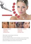 4 Wavelengths Honeycomb Nd Yag Laser Picosecond Laser 1064nm Tattoo Delete