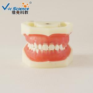 Quality Professional Medical Dental Study Models VIC-L5 Peridontal Disease Model wholesale