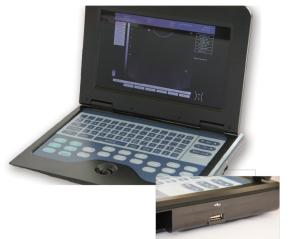 Pregnancy Diagnosis Ultrasound Scanner Machine System 0~120dB Adjustable