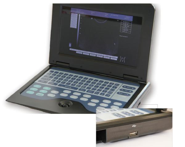 Cheap Pregnancy Diagnosis Ultrasound Scanner Machine System 0~120dB Adjustable for sale