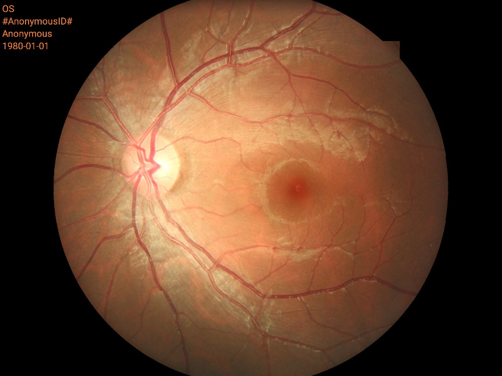 Portable Digital Fundus Camera with Ce Approval (HA06)