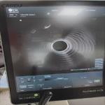 BK Medical 2052 Intra-cavitary Ultrasound Probe