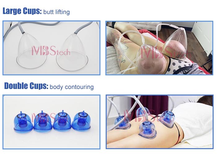 Lymphatic Drainage Vacuum Therapy Buttocks Enhancement Machine 99KPA