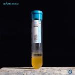 Relieve Pain PRP Test Tube 20ml ACD-A With GEL For OA Treatment