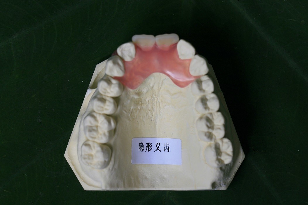 Temporary Soft And Elastic Valplast Invisible Denture