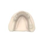 Beige Orthodontic Opposite Jaw Model Resin