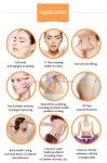 Ultrasound RF Face Wrinkle Removal Machine Anti Puffiness Anti Aging