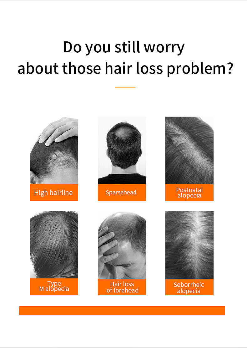 30ml Hair Growth Serum