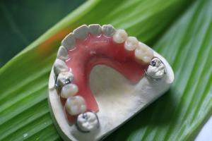 Quality Partial Flexible Invisible Denture For Anterior Teeth wholesale