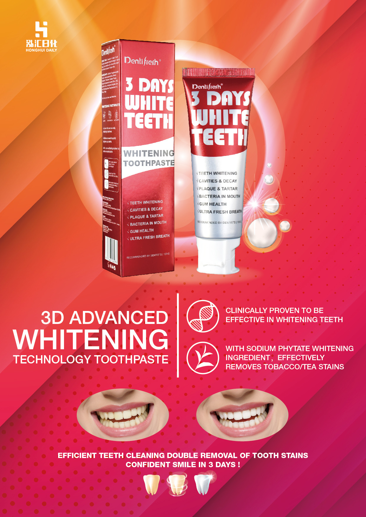Safe and Non-irritating 120g whitening Toothpaste for Lasting Dental Protection