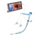 Video Combined Double Lumen Endobronchial Tube Ultimate Surgical Solution With