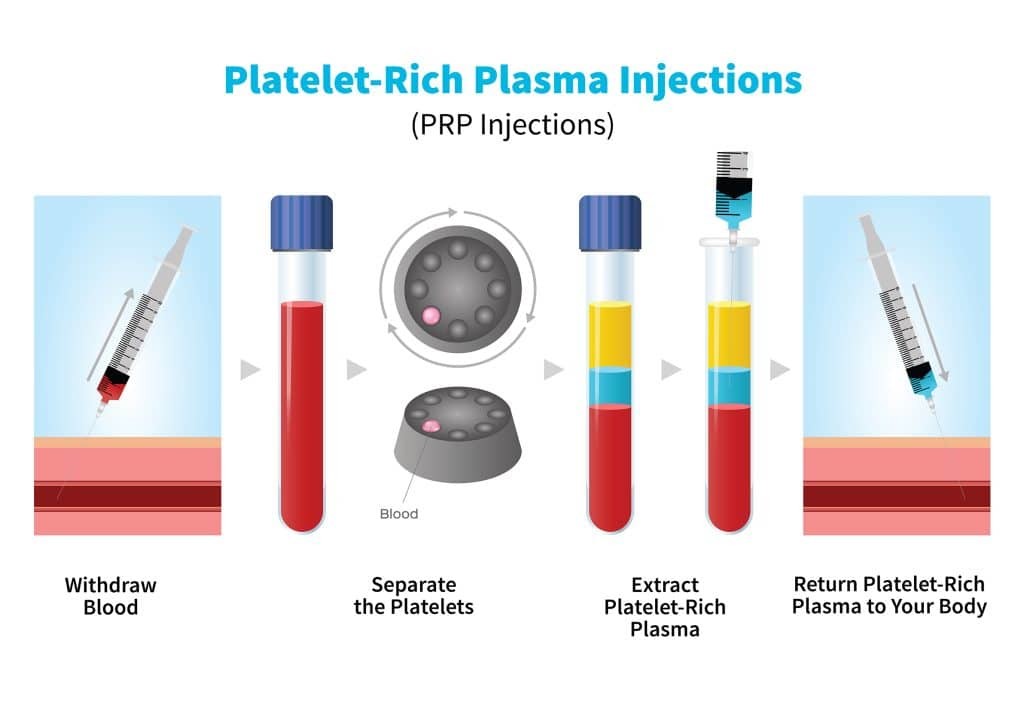 TD4A Machine Platelet Rich Plasma Blood Separator Laboratory Centrifuge PRF PRP Centrifuge