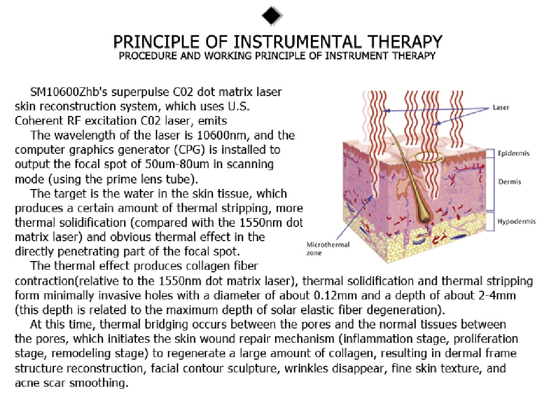 China factory direct sales carbon dioxide skin resurfacing fractional laser for stretch marks