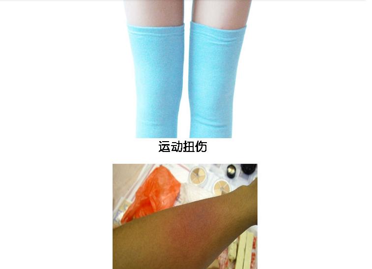 280g first aid cold pack with high quality