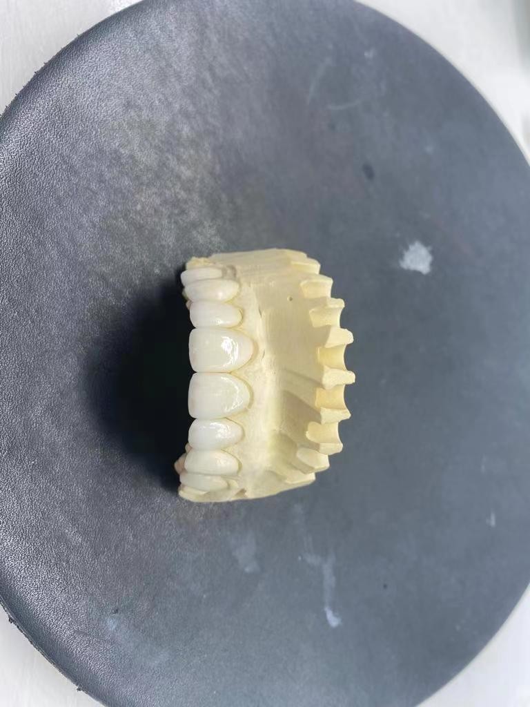 Yucera Dental CAD CAM Zirconia Blocks UT White High Translucent For Veneer