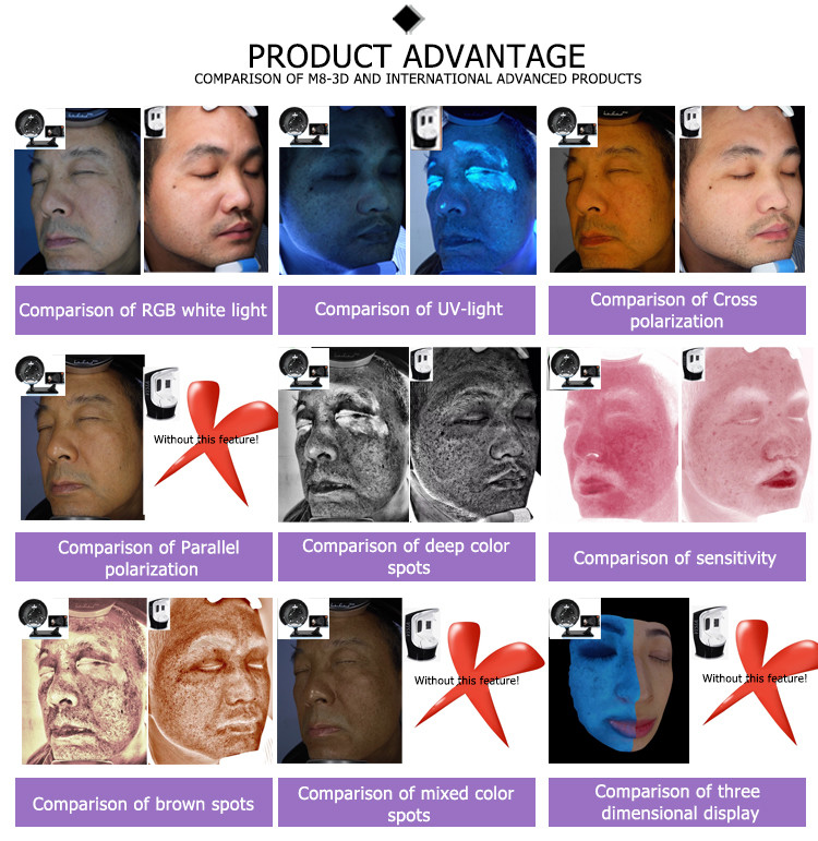 magic mirror skin analyzer health analyzer UV Images skin analyzer CE approval machine beauty device skin 3d analyzing