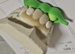 Resin Metal Free Invisible Denture For Allergic Patient