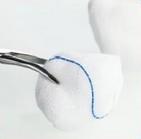 Quality Medical Gauze Balls 100% Bleached Cotton 100 Pcs/Pack ce certification wholesale