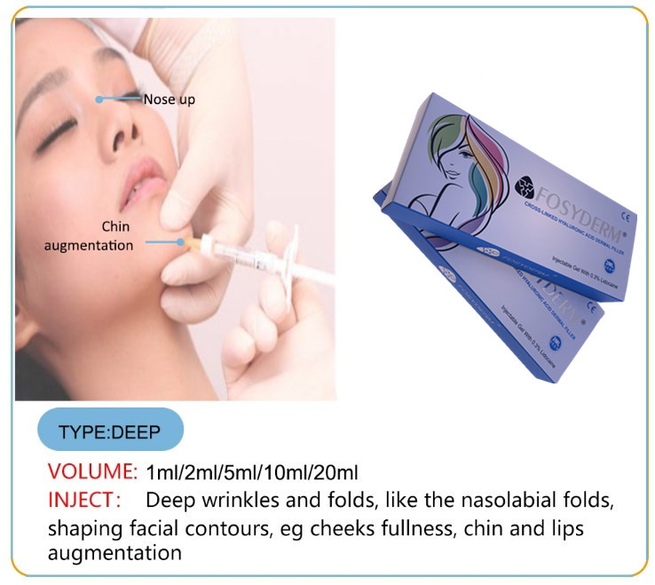 Fosyderm Deep Hyaluronic Acid 1ml HA Dermal Fillers Anti Aging