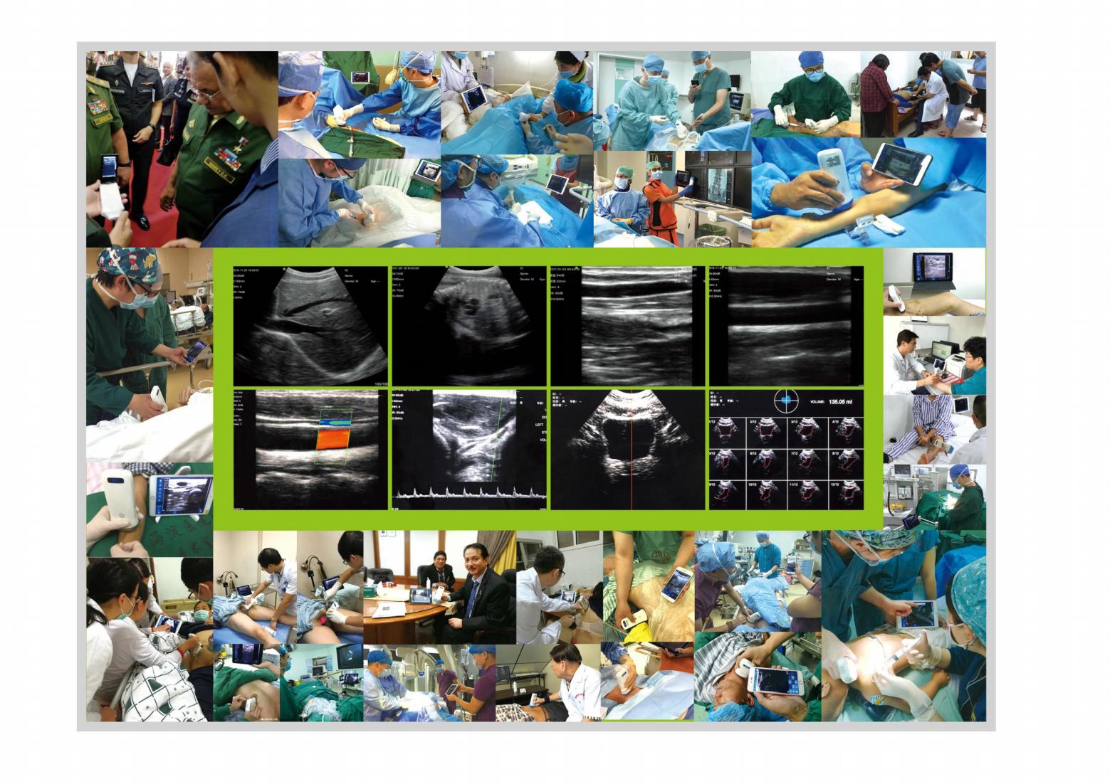 New products Phone / Android wireless USB probe mobile phone ultrasound for clinic