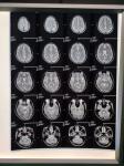 210 Microns Inkjet X Ray Film A3