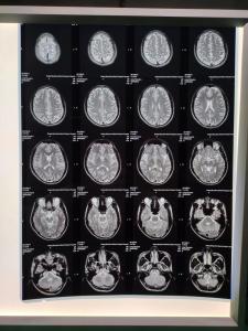 Quality 210 Microns Inkjet X Ray Film A3 wholesale