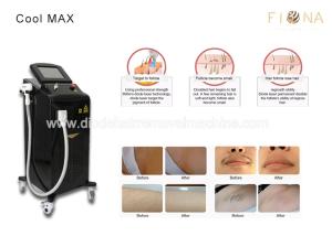 Quality Fast Safe Commercial Laser Hair Removal Machine Painless Permanent Treatment wholesale