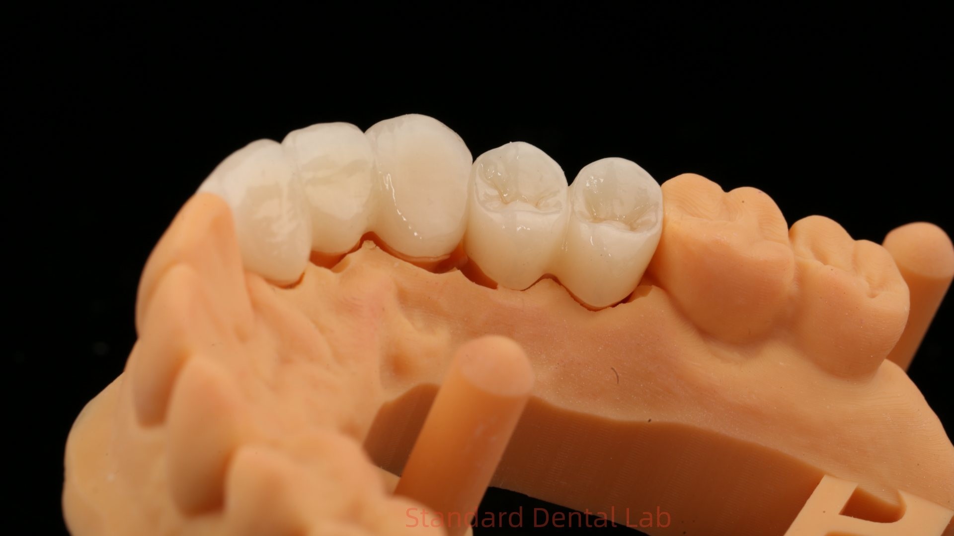 High Aesthetic Anterior Teeth Full Contour Zirconia Crown with Customized Vita Shade Dental Lab